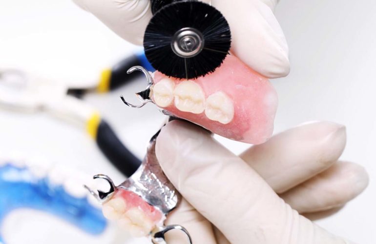 Denture repairs
