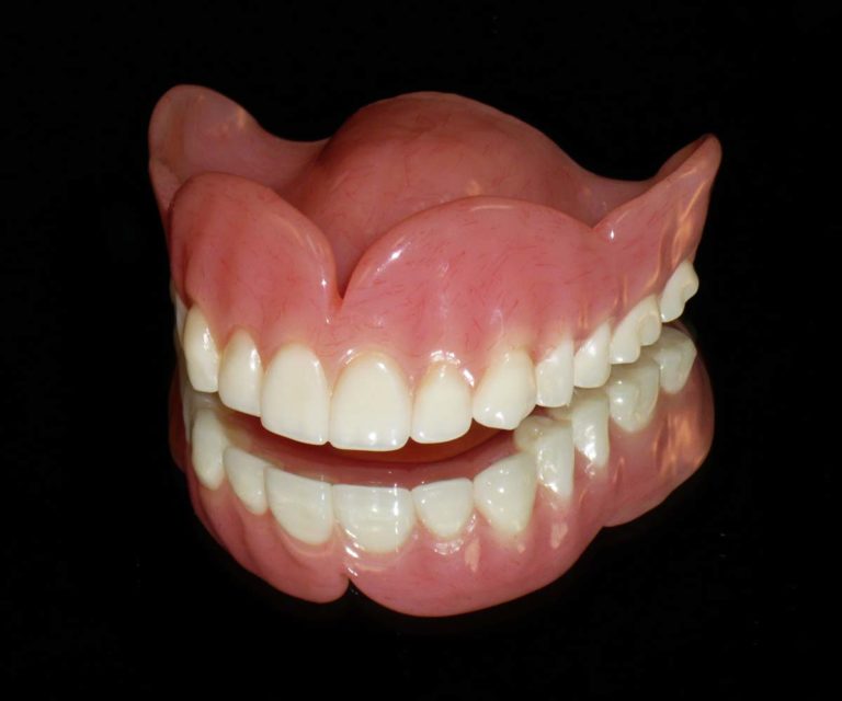 Complete Dentures Edmonton South Centre Denture Clinic   Complete Full Dentures 768x640 